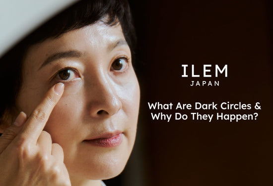 What are dark circles & why do they happen by ILEM JAPAN