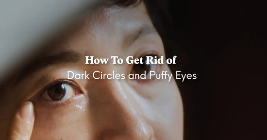 Get Rid of dark circles